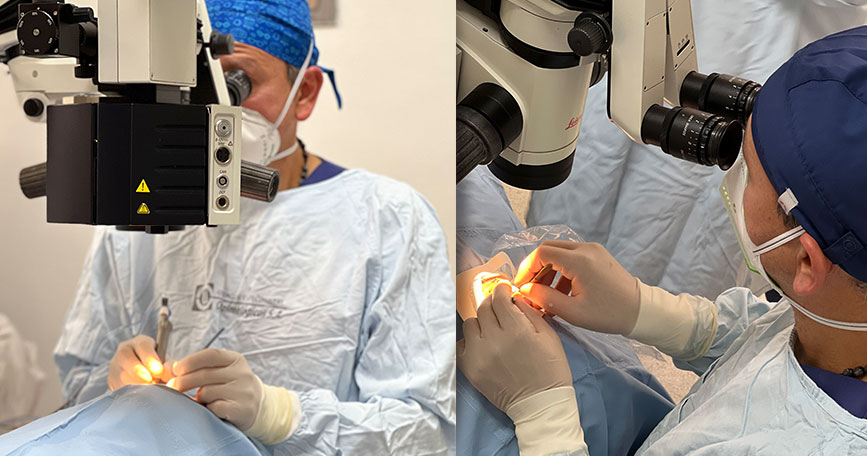 Cirugía oftalmológica avanzada con tecnología laser